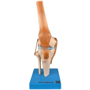 Articulação do Joelho com Ligamentos