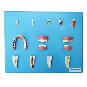 Patologia Dentária com 12 Peças