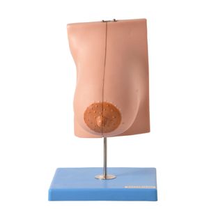 Glândula Mamária em Lactação
