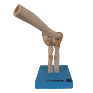 Articulação do Cotovelo com Ligamentos