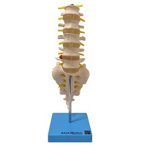 Coluna Vertebral Lombar