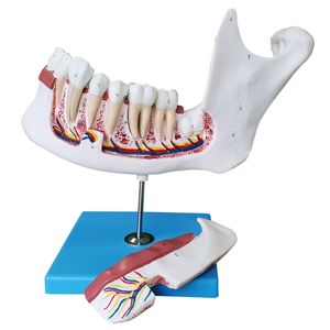 Anatomia do Dente e Mandíbula Inferior de um Jovem (18 anos) em 6 Partes